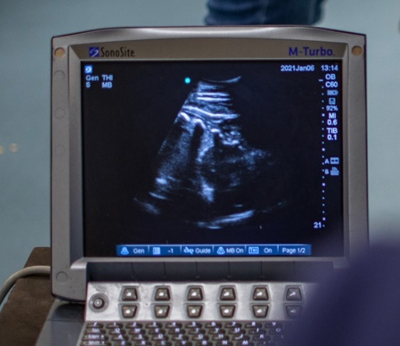 Pregnancy Management